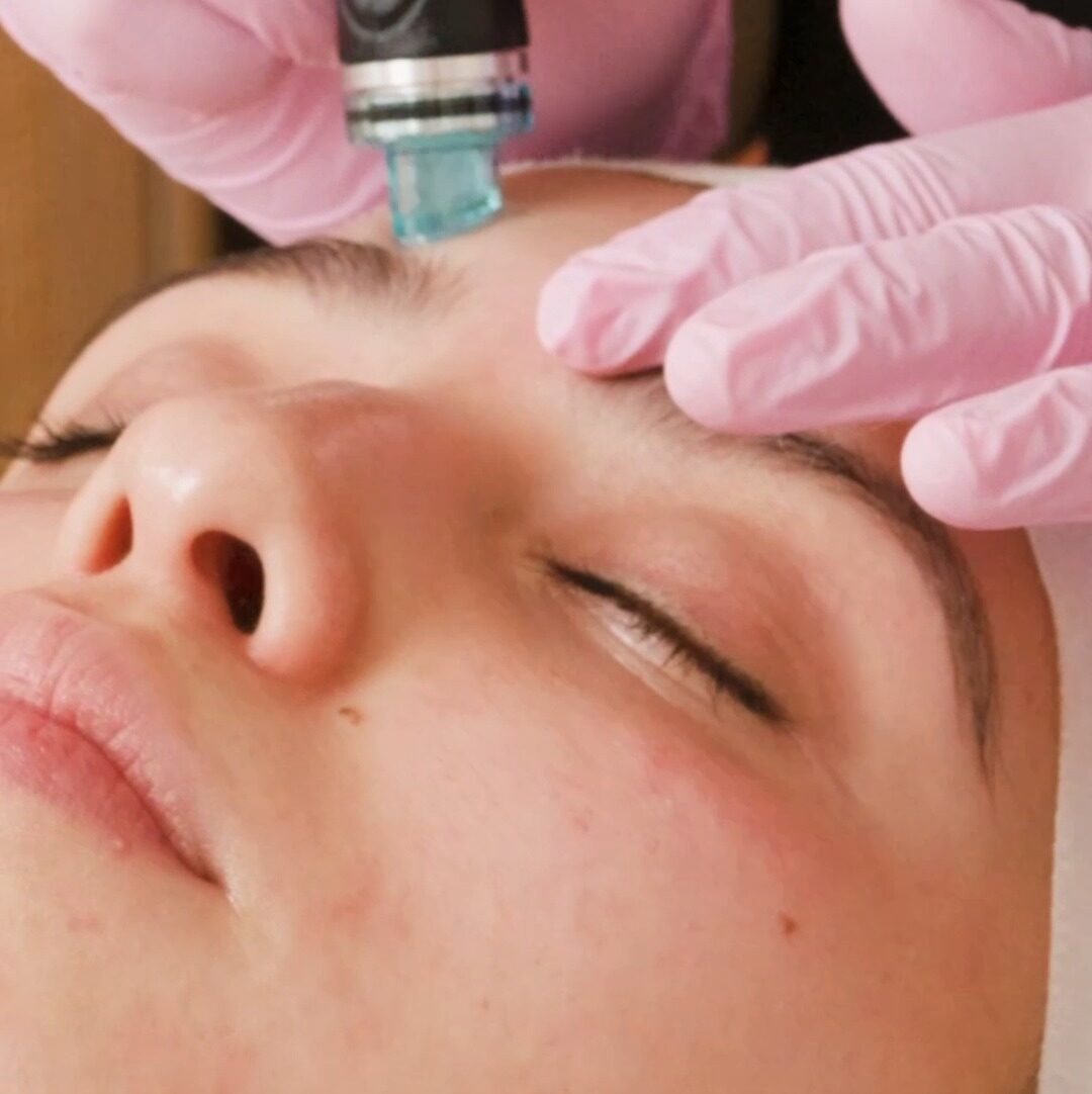 Hydrafacial -3-0 Hydrafacial 3 0 e1746924486101