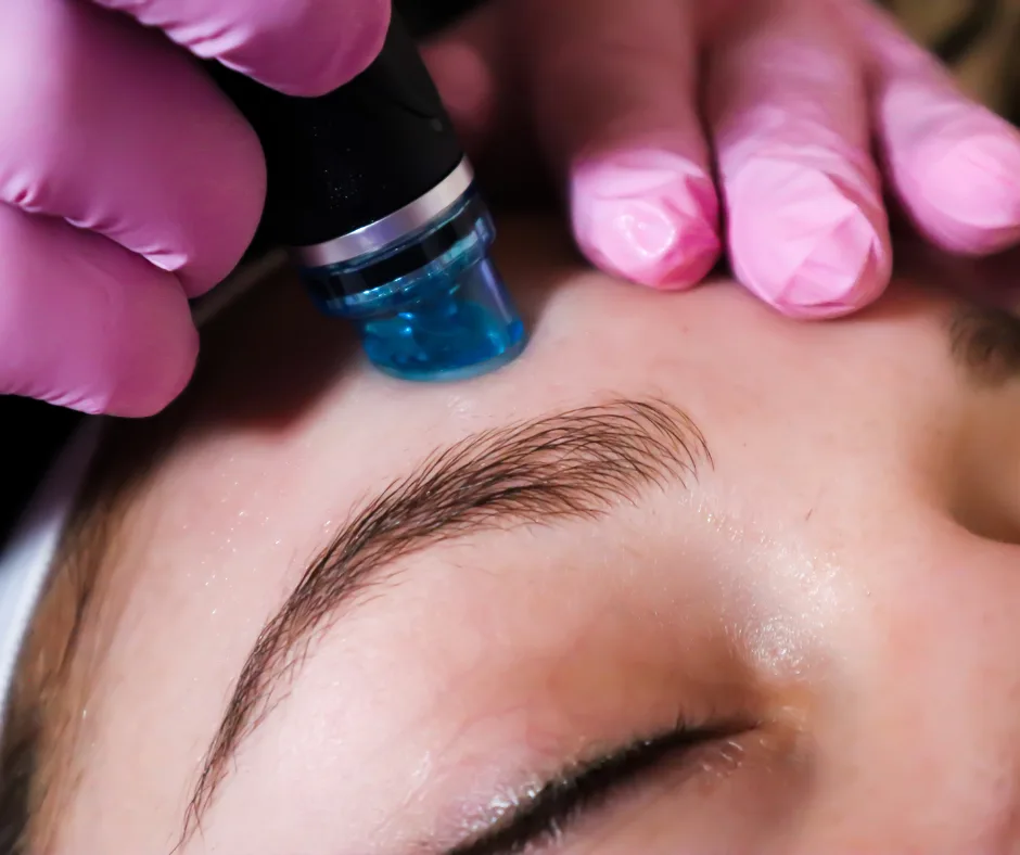 Extracting-with-Hydrafacial- Extracting with Hydrafacial