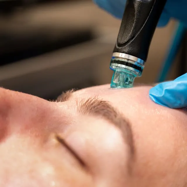 Peaches + Co Hydrafacial Peaches Co Hydrafacial