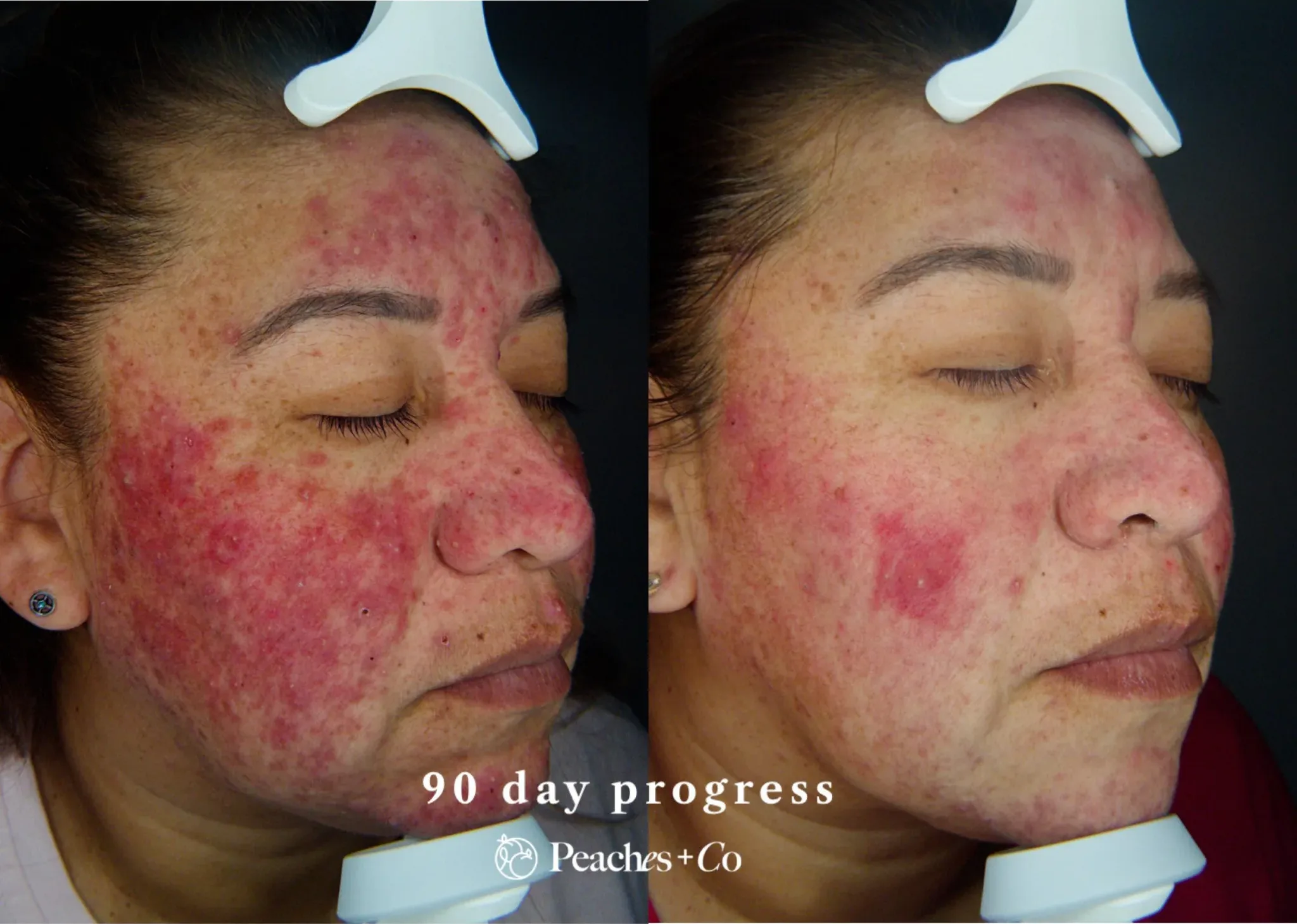 WhatsApp Image 2025 11 11 at 18.00.01 scaled e1762902200298