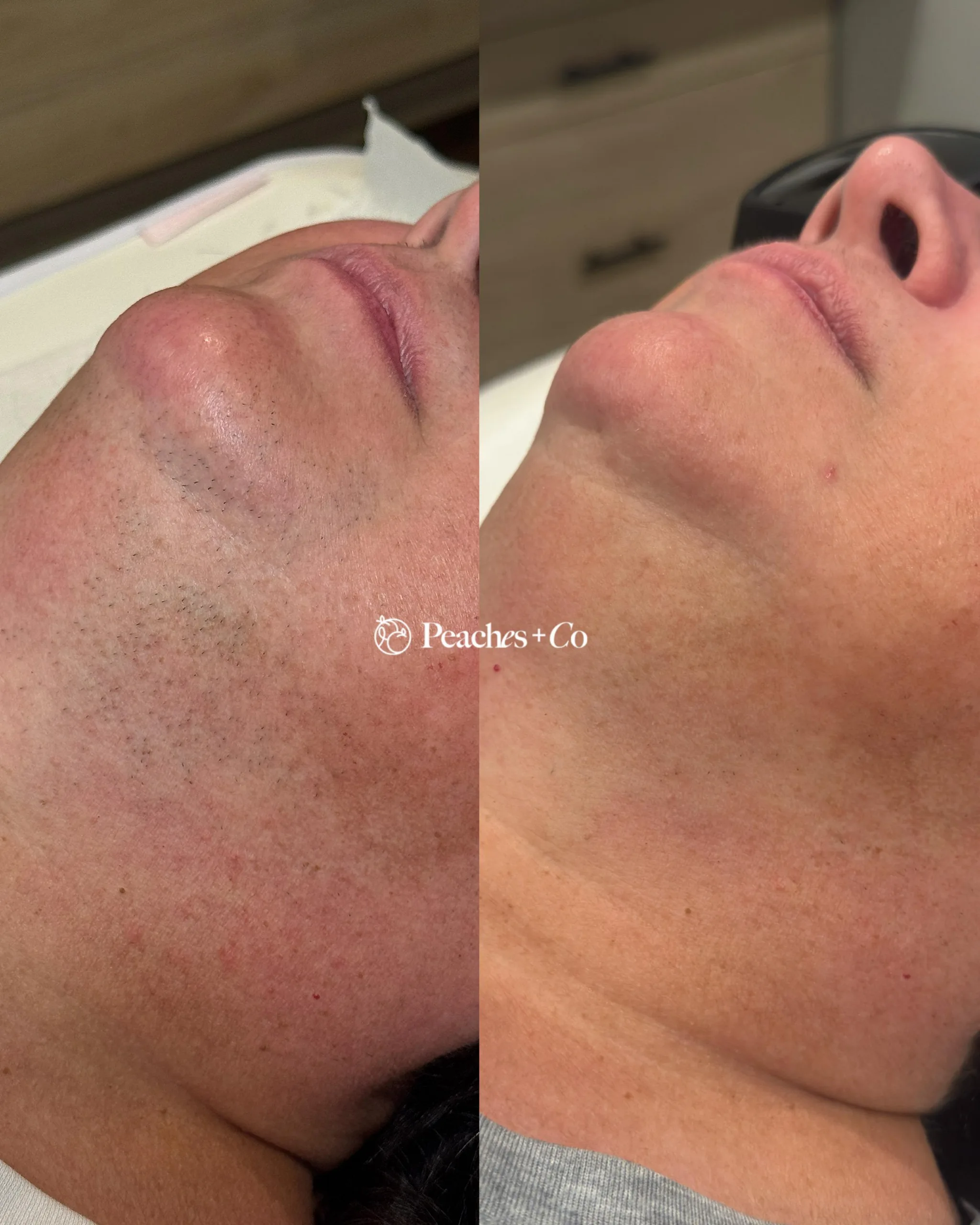 WhatsApp Image 2026 02 19 at 00.06.17 1 scaled