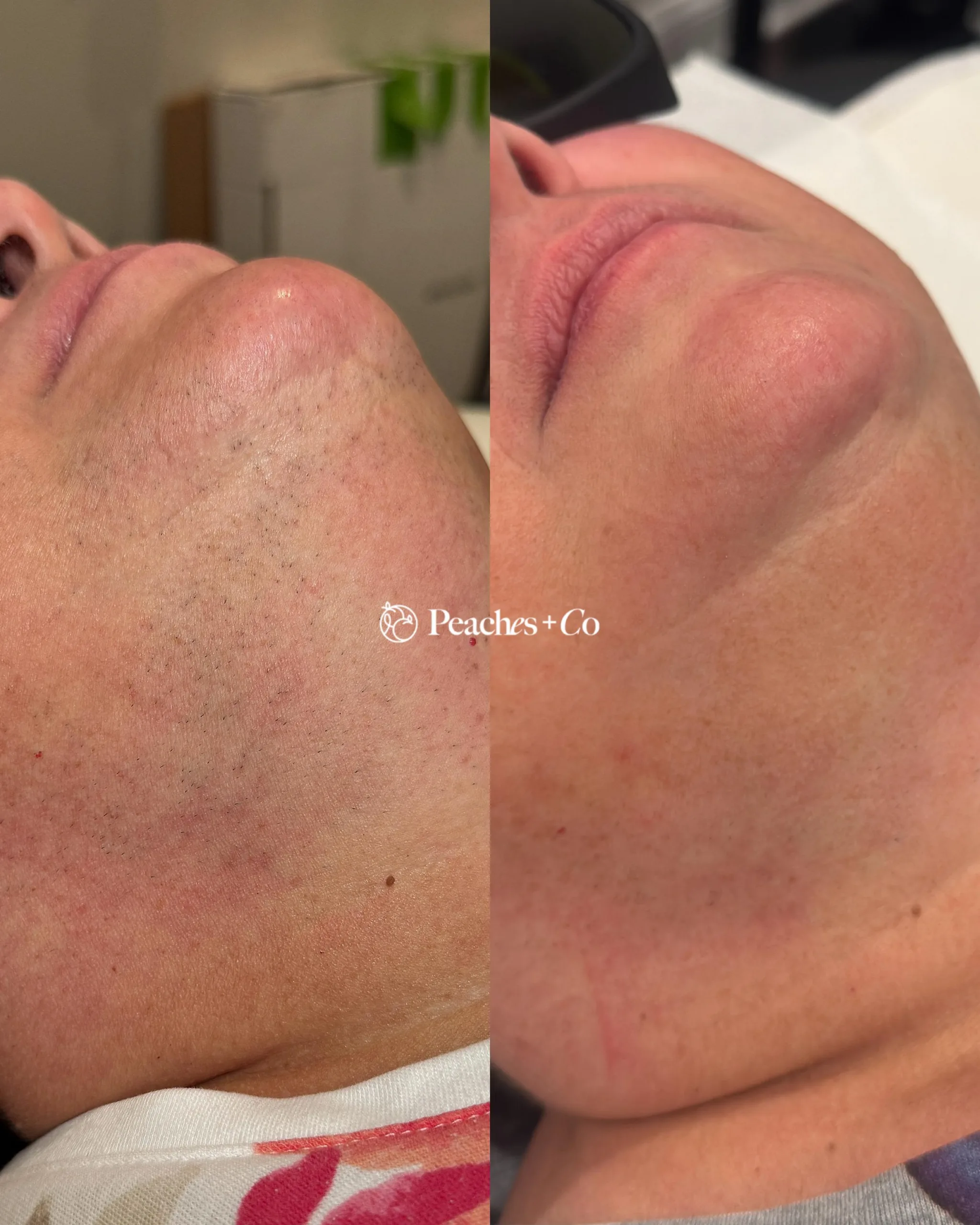 WhatsApp Image 2026 02 19 at 00.06.17 scaled